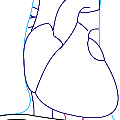 Drawings